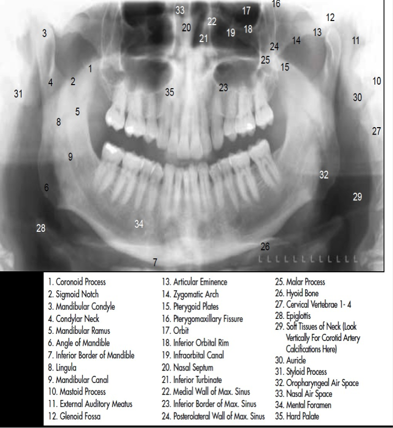 Successful Panoramic Radiography at ADK Hospital.::. Caring about you ...